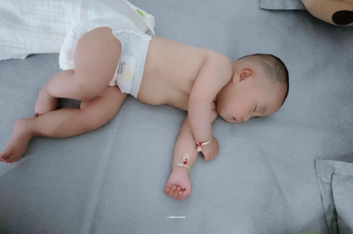 莒县六个月宝宝眼睛散光